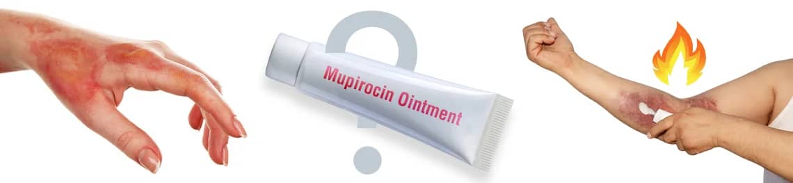 Mupirocin Ointment For Burns in a webp image