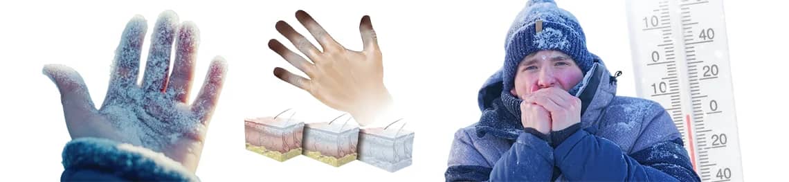 How Long Does It Take To Get Frostbite in a webp image