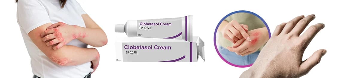 side effects of clobetasol cream in a webp image