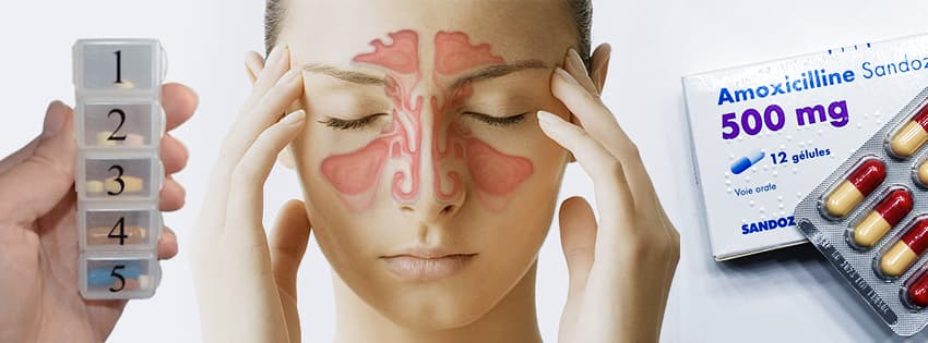 amoxicillin tablet for sinus infection