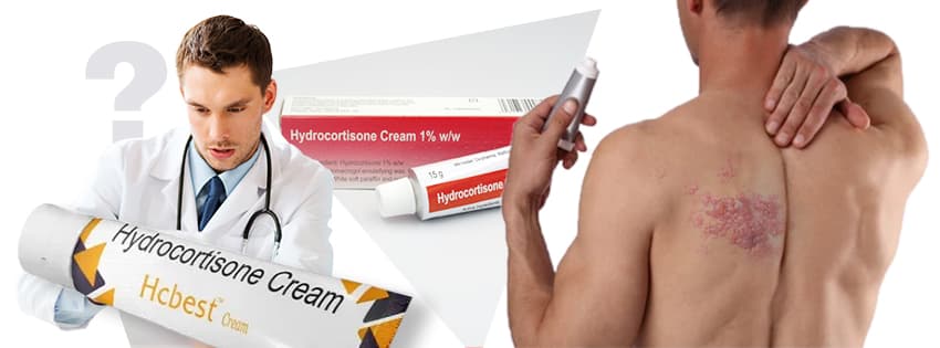 Can I use hydrocortisone cream on shingles rash blog image