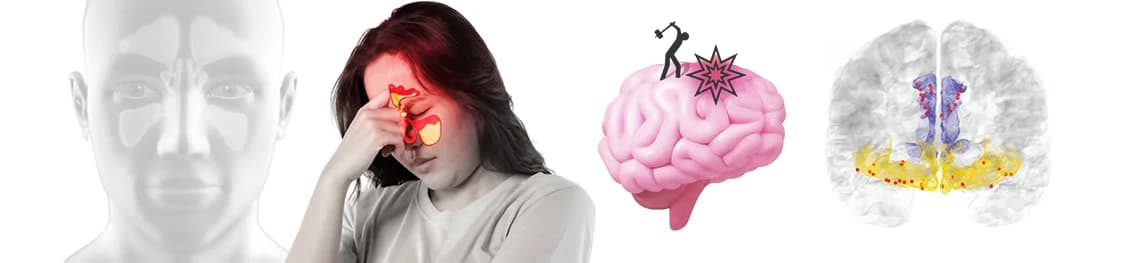 How-to-tell-if-sinus-infection-has-spread-to-brain in a webp image
