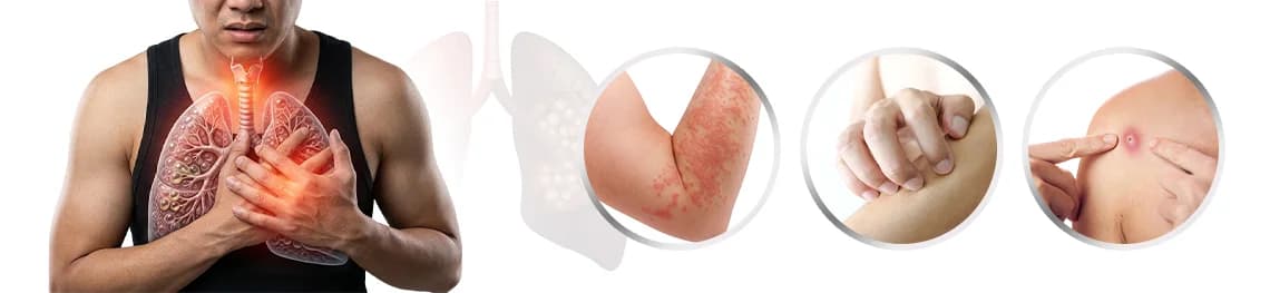 Lung Cancer Symptoms on Skin in a webp image
