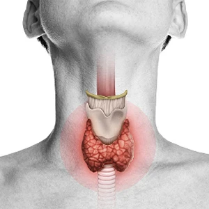 Hypothyroidism