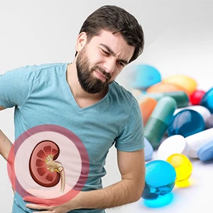 Kidney Stones