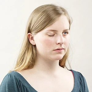 Myasthenia gravis (Musle Disease)