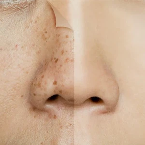 Pigmenting Agent