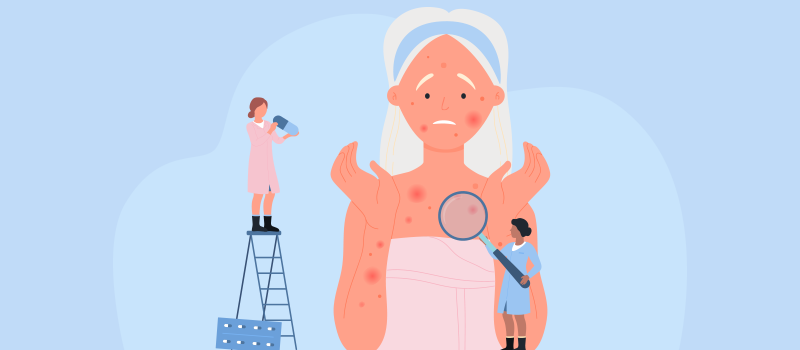 Understanding the Benefits of Gabapentin for Shingles: A Comprehensive Guide for Patients