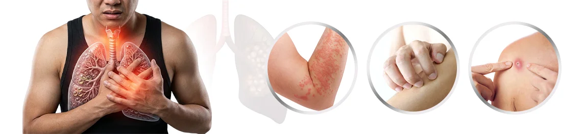 Lung Cancer Symptoms on Skin