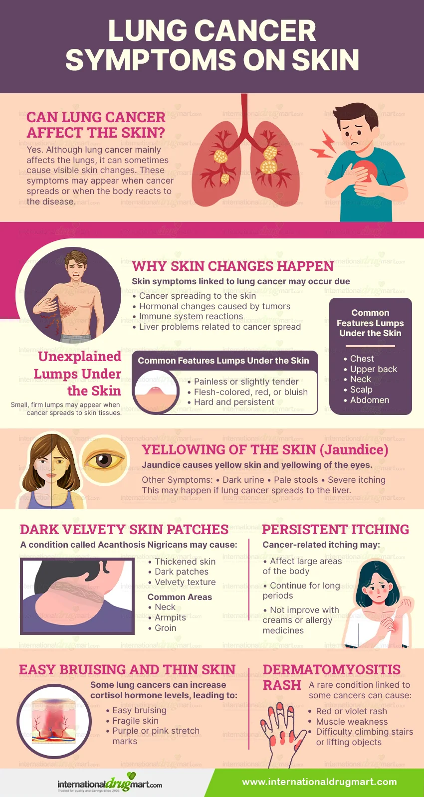 Lung Cancer Symptoms on Skin in a webp image